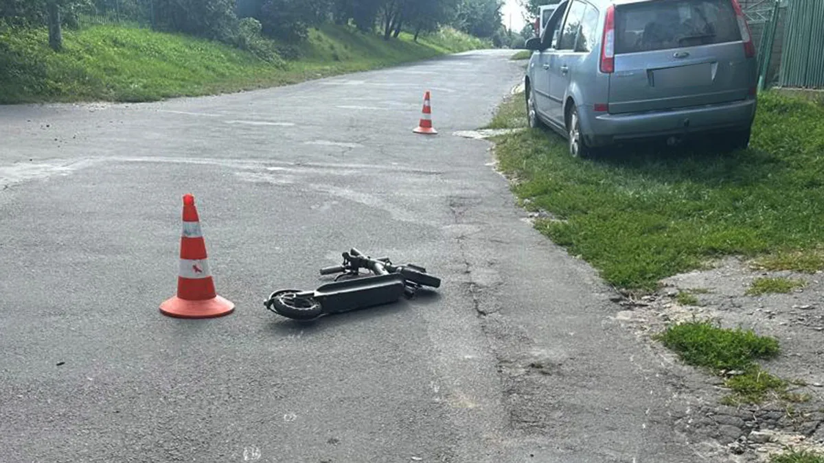 У Хмельницькому переломами закінчилась ДТП за участі електросамоката: що загрожує водійці автомобіля