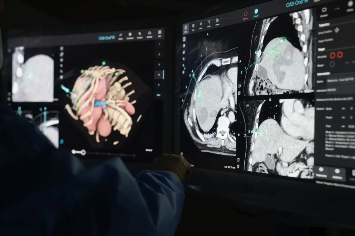 львів, ШІ, операція