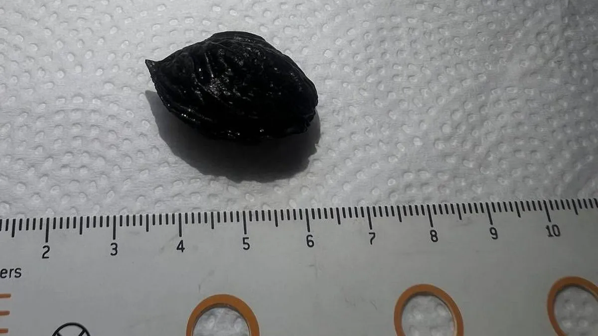 персик, кісточка, лікарня