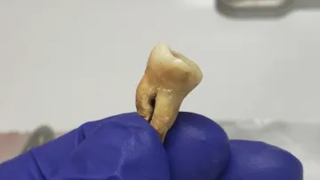 Дослідники розкрили історію першої людської пандемії: знахідка в Йорданії вразила світ