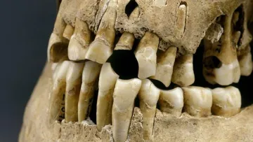 Що їли та на що страждали: вчені відтворили життя людей залізної доби за їхніми зубами