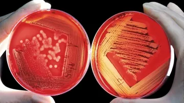 «Скриньку Пандори‎» знайшли у Румунії: у підземній печері виявили бактерії, які стійкі до 10 антибіотиків