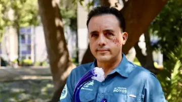 «З бойовим шрамом, схожим на зябра»: біолог вижив після нападу акули й хоче зустріти її знову