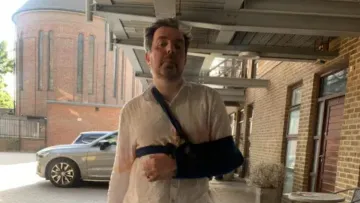 Чоловік з найбільшим пенісом у світі травмувався через свого прутня: що сталося та про який розмір йдеться