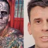 «Це дуже болісно»: бразилець з найбільшою кількістю тату взявся виводити свій «натільний живопис» з обличчя 