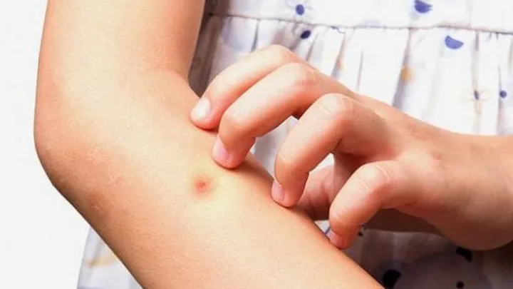 Новий вірус лихоманки шириться Китаєм: понад 6 тисяч випадків за три тижні, ліків поки немає