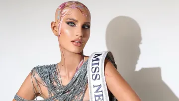 Зняла перуку просто під час конкурсу: учасниця «Міс США» з облисінням здивувала спільноту – як вона виглядає