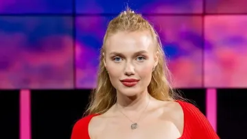 Зірка «Холостяка» з Тереном показала, як облисіла через хворобу: фото до та після