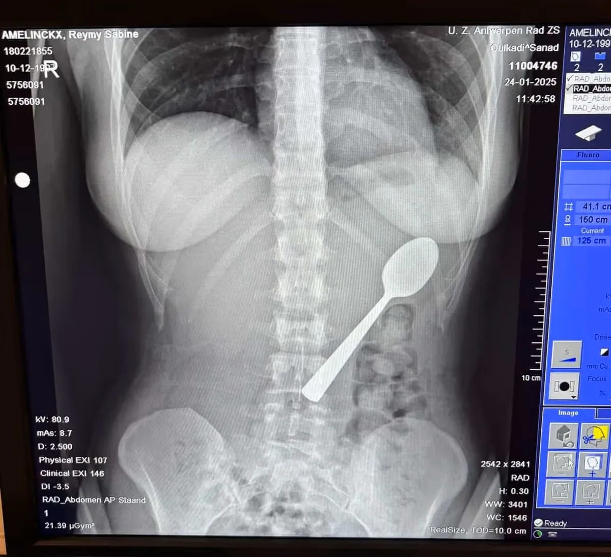 собака, ложка, бельгійка