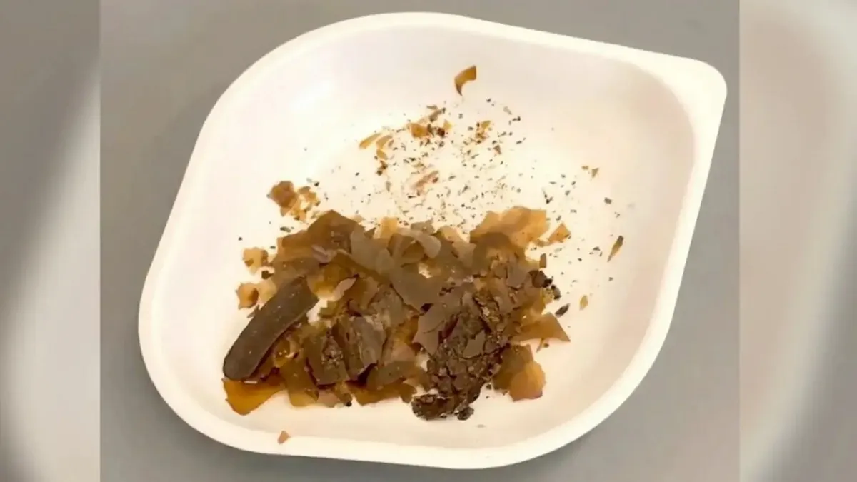 медицина, фекалії