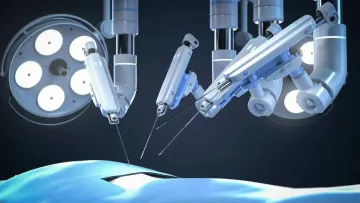 В Португалії провели повністю роботизовану трансплантацію нирки від людини до людини: чи вижили пацієнти