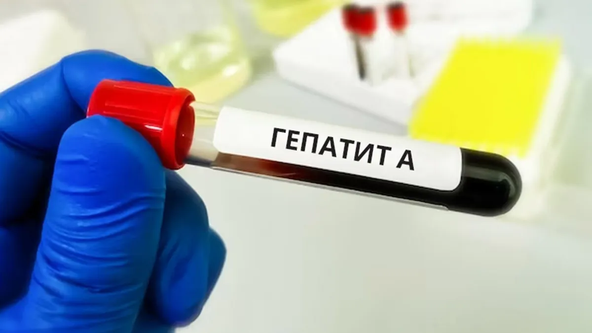 Спалах гепатиту А в Києві: як розпізнати хворобу брудних рук і коли звертатися до лікаря