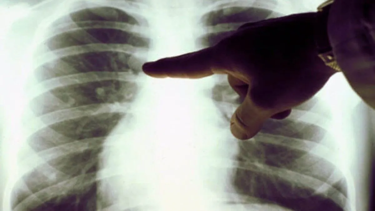 Курцям і не лише до уваги: п'ять продуктів, які допоможуть захистити легені від впливу токсинів