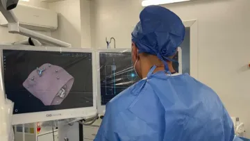 У Львові лікарі за допомогою ШІ знищили три метастази в печінці: деталі унікальної операції