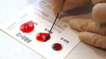 Стрес, проблеми з пам'яттю і не тільки: як група крові може вплинути на ваше здоров'я
