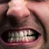 Стрес, що стирає зуби: чому бруксизм став масовим в Україні – пояснення стоматологині
