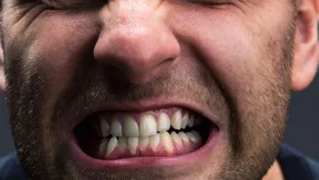 Стрес, що стирає зуби: чому бруксизм став масовим в Україні – пояснення стоматологині