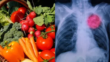 Онколог зробив шокуючу заяву: лікар назвав продукти, які можуть збільшити ризик раку