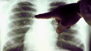 Курцям і не лише до уваги: п'ять продуктів, які допоможуть захистити легені від впливу токсинів