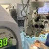 У МОЗ повідомили, що катаракту в Україні оперують безоплатно: де за хірургічне втручання не доведеться платити