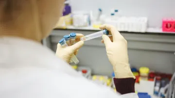 Європою шириться мавпяча віспа: що це та як захиститись від небезпечного захворювання