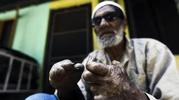 Хвороба, яка лютувала у середньовічній Європі, зафіксована у двох країнах: одна з них межує з Україною