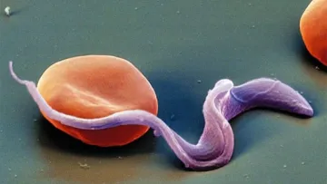 Чарівної таблетки від паразитів не існує: лікарі розповіли, як їх виявити та правильно з ними боротися