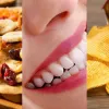 Стоматологи б'ють на сполох: Названо топ-5 продуктів, які вбивають зуби швидше за шоколад