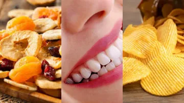 Стоматологи б'ють на сполох: Названо топ-5 продуктів, які вбивають зуби швидше за шоколад