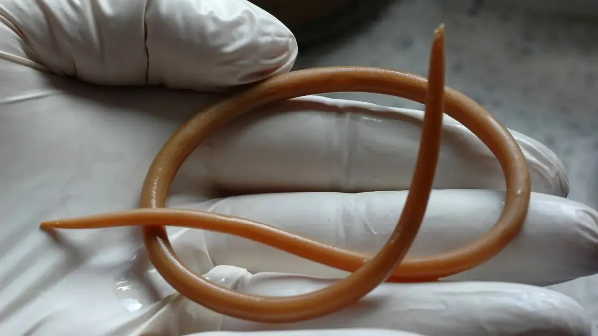 Паразит, що спричиняє легеневу інфекцію: у тілі жінки виявили черв’яка, який раніше не вражав людей