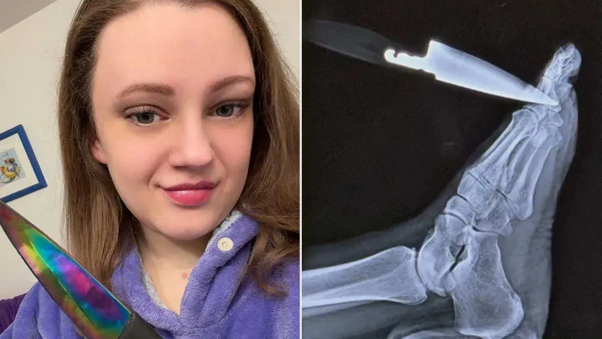 Фатальна випадковість, що стала порятунком: жінка встромила ніж у ногу та дізналася про страшний діагноз