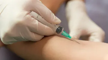 В Україні відмовляються від проби Манту: що відомо про сучасні методи діагностики туберкульозу