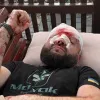 На Одещині військового жорстоко побили після зауваження через російську музику: деталі інциденту 