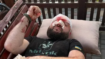 На Одещині військового жорстоко побили після зауваження через російську музику: деталі інциденту 