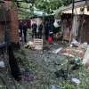 Вдалося запобігти ампутації ніжки: лікарі врятували кінцівку немовляти після російського обстрілу Кривого Рогу