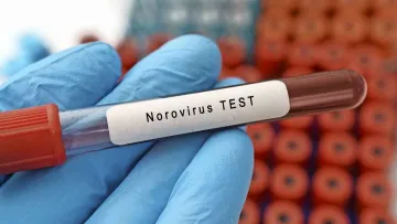 Висока заразність та регулярні візити в туалет: що потрібно знати про норовірус