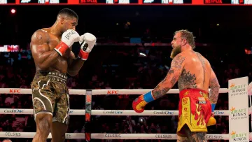 У Джейка Пола подвійний перелом щелепи та титанові пластини: які наслідки нокауту від Ентоні Джошуа