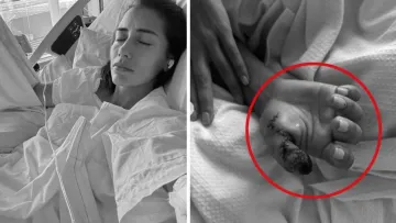 Манікюр ціною в палець: жінка ледь не померла через брудні інструменти в салоні