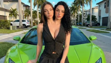 «Народилися» місяць тому й підкорили соцмережі: у чому небезпечний секрет сіамських близнючок з Instagram