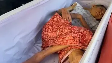 Неймовірний випадок перед кремацією: як «померла» жінка раптом ожила